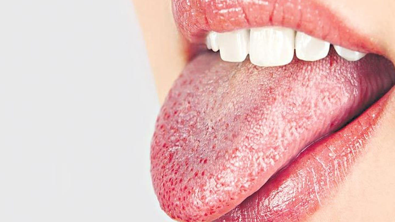 ఇక నాలుకపై మచ్చలు ఉండటం మాత్రం అశుభకరం అంటున్నారు సాముద్రిక శాస్త్ర నిపుణులు. ఇలా నాలుకపై మచ్చలు ఉన్నవారు, తొందరపడి మాట్లాడటం  మంచిది కాదంట. ఎందుకంటే వారు, మాట్లాడేది నిజం అయ్యే అవకాశం ఎక్కువగా ఉంటుందంట. అందుకే వారు ఎక్కువగా ఆలోచించి మంచి విషయాలే మాట్లాడలని చెబుతున్నారు పండితులు.