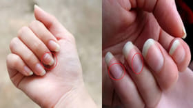 మీ గోళ్లలోనే మీ హెల్త్ సీక్రెట్స్.. వీటిని లైట్ తీసుకున్నారో..