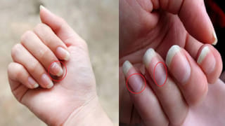 మహిళల కంటే మగవాళ్లే ఎందుకు ఎక్కువ గురక పెడతారు..? అసలు రహస్యం తెలిస్తే షాకే..