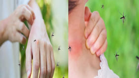 దోమలు కొంతమందినే ఎందుకు కుడుతాయి.. మీ శరీరంలో దాగివున్న ఈ రహస్యం