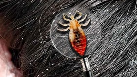 బాలిక తలనుంచి అదొరకం వాసన.. హస్పిటల్‌కు తీసుకెళ్లగా..