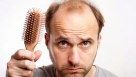 అబ్బాయిలూ జర జాగ్రత్త.! వీటి వల్ల జుట్టు రాలిపోయి బట్టతల వస్తుంది