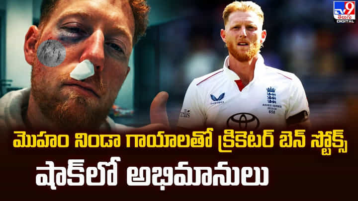 మొహం నిండా గాయాలతో క్రికెటర్ బెన్ స్టోక్స్.. షాక్ లో అభిమానులు మొహం నిండా గాయాలతో క్రికెటర్ బెన్ స్టోక్స్.. షాక్ లో అభిమానులు