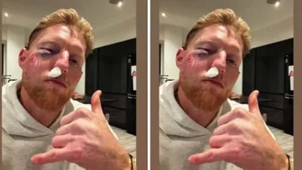 Ben Stokes Face Injury: స్టార్ ప్లేయర్కు గాయం.. గుర్తు పట్టలేనంతగా రక్తం తడిసిపోయిన ముఖం.. అసలేమైంది ?