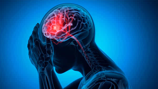 Brain stroke: బ్రెయిన్ స్ట్రోక్ వచ్చే ముందు మీలో వచ్చే లక్షణాలు ఇవే..