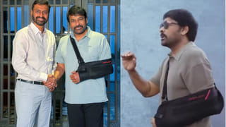 Chiranjeevi: చేతికి కట్టు.. ఏం జరిగిందో చెప్పిన మెగాస్టార్ చిరంజీవి