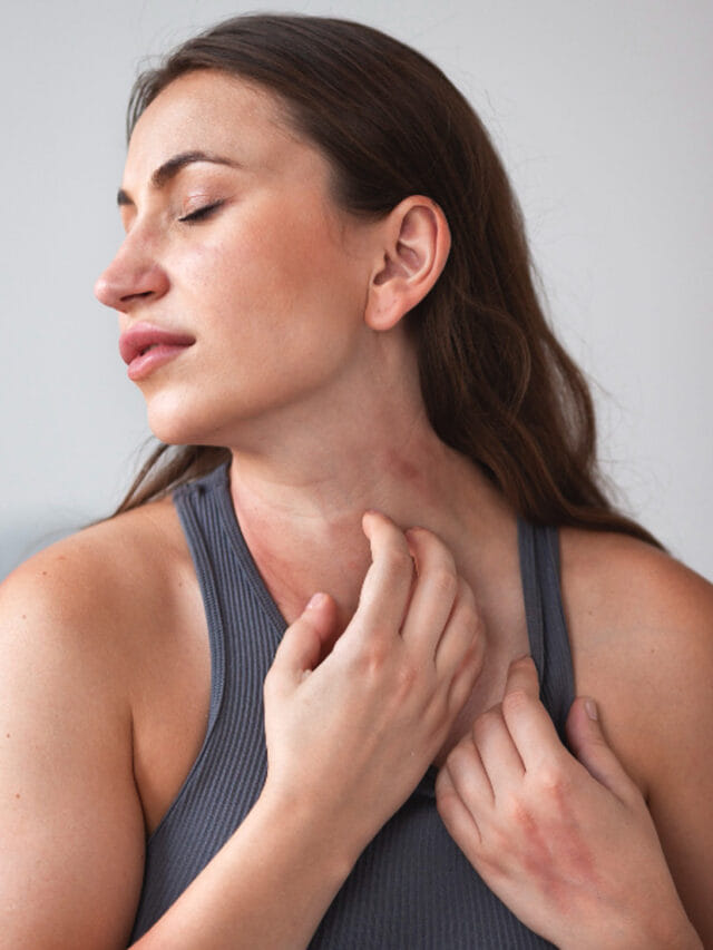 కొత్తిమీర మంచిదే కానీ, వారికి మాత్రం విషంతో సమానం