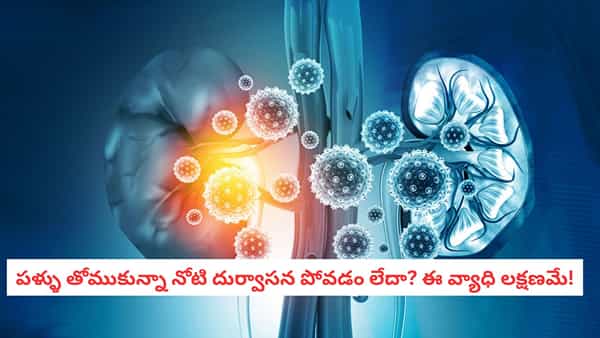 Kidney Health: కిడ్నీ ఫెయిల్యూర్ కావడానికి 3 నెలల ముందే కనిపించే ఆ 5 లక్షణాలు ఇవే..
