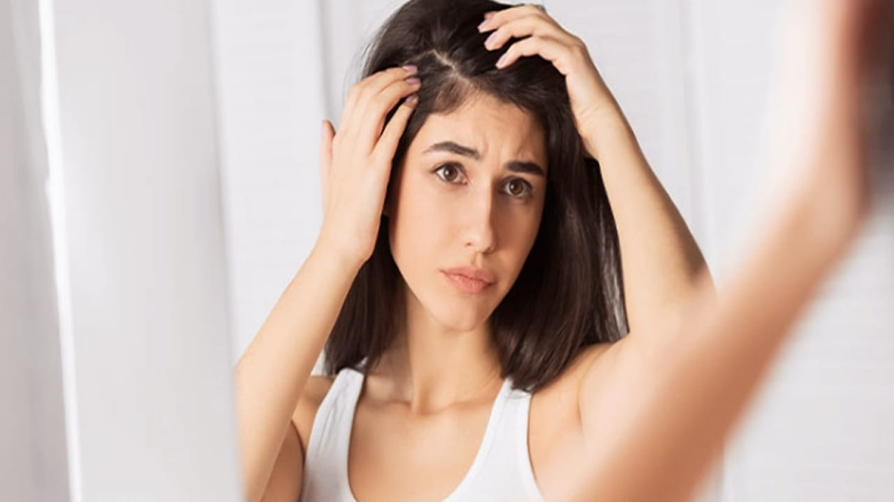 
పెరుగు:  పెరుగులో ఉండే  యాంటీ ఫంగల్  చుండ్రు సమస్యకు చెక్ పెడుతోంది. కాబట్టి, దీనిని మీ ఫుడ్ డైట్ లో చేర్చుకోండి. ఎందుకంటే, పెరుగును తిన్న తర్వాత తలలో చుండ్రు మొత్తం తగ్గుతుంది. 
