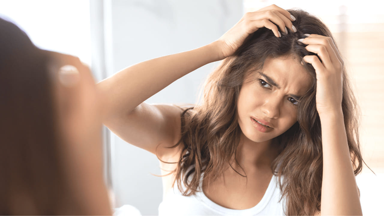 నిమ్మకాయ: నిమ్మకాయ మన ఆరోగ్యానికే కాదు చుండ్రును కూడా తగ్గిస్తుంది. దీనిలో ఉండే  ఆమ్లం చుండ్రును పూర్తిగా తగ్గించి ఆ సమస్య నుంచి ఉపశమనం పొందేలా చేస్తుంది.
