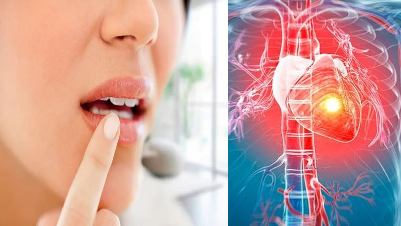 పెదవులలో ఈ చిన్న మార్పు కనిపిస్తే నిర్లక్ష్యం చేయొద్దు – గుండెపోటుకు ముందస్తు హెచ్చరిక..!