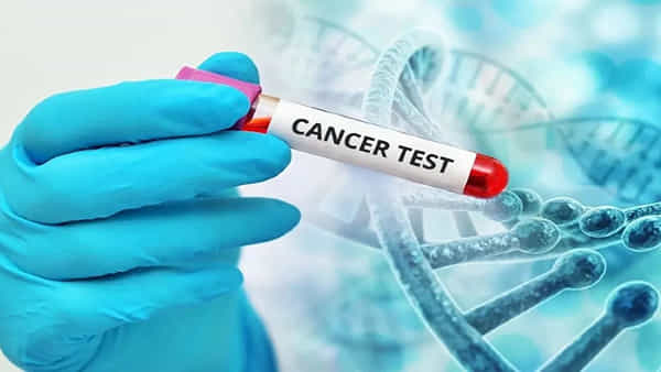 క్యాన్సర్ రమ్మన్నా రాదు.. వీటి జోలికి వెళ్లకపోతే చాలు.. పరిశోధనలో షాకింగ్ విషయాలు..