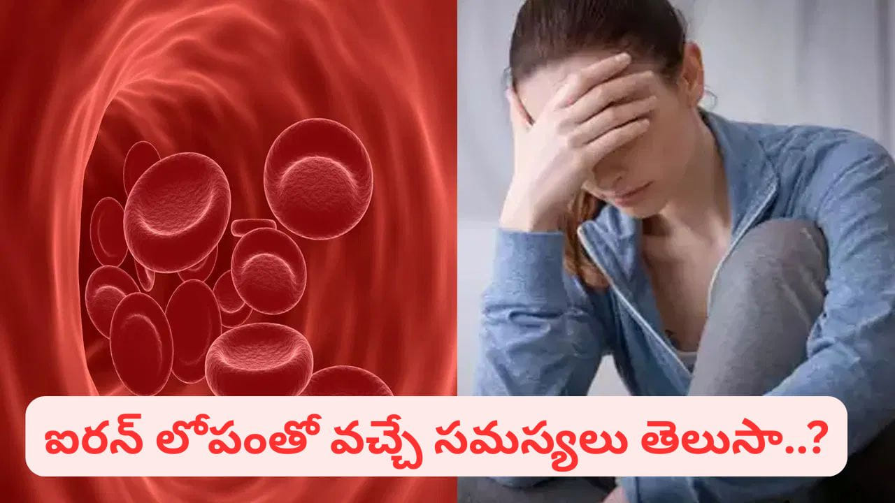 Iron Deficiency: మహిళల్లో ఐరన్ లోపం ఎందుకు వస్తుంది? ఈ విషయాలు తప్పక తెలుసుకోండి