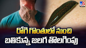 రోగి గొంతులో నుంచి.. బతికున్న జలగ తొలగింపు