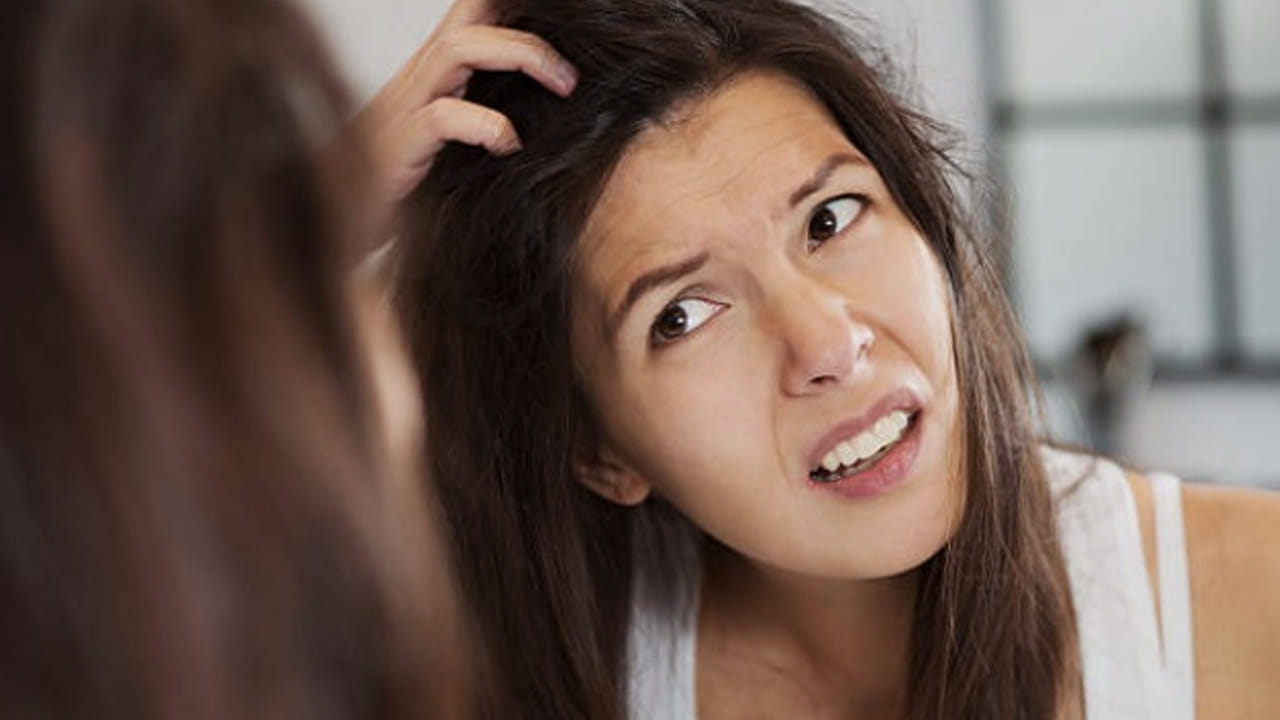 నిమ్మ రసం: పేలు బాగా ఉన్నప్పుడు నిమ్మ రసాన్ని తలకు పట్టించి,40 నిమిషాలు ఉంచుకుని ఆ తర్వాత తలస్నానం చేస్తే పేలు మొత్తం పోతాయి. నెలలో మూడు సార్లు నిమ్మరసాన్ని పెట్టుకుంటే మంచి ఫలితం ఉంటుంది.