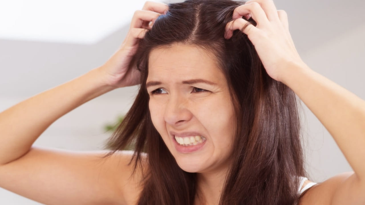 పేలకు పోగొట్టడానికి హాస్పిటల్స్ చుట్టూ తిరిగే బదులు పైన చెప్పిన సహజ చిట్కాలను పాటించి పేల సమస్యకు చెక్ పెట్టండి. (NOTE: ఇందులోని అంశాలు కేవలం అవగాహన కోసం మాత్రమే. నిపుణులు అందించిన సమాచారం ప్రకారం ఇక్కడ తెలియజేయడమైనది. ఆరోగ్యరీత్యా ఎలాంటి సమస్యలు ఉన్నానేరుగా వైద్య నిపుణులను సంప్రదించడం మంచిది)