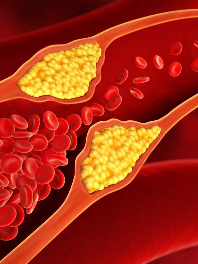 ఈ ఫుడ్స్ చెడు కొలెస్ట్రాల్ ను సీక్రెట్ గా పెంచుతున్నాయి.. ఆపకపోతే డేంజర్లో పడ్డట్టే?