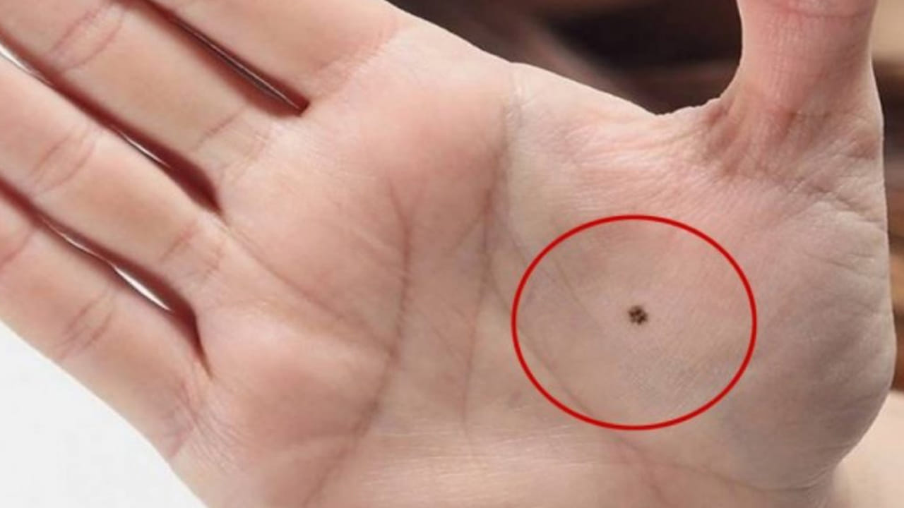 అరచేతిలో పుట్టు మచ్చ ఉంటే చాలా అదృష్టం అని చెప్పాలి. ఏ స్త్రీకి అయితే అర చేతి మధ్య భాగంలో పుట్టు మచ్చ ఉంటుందో వారు జీవితంలో కోటీ శ్వరులు అవుతారంట. వీరికి దానం చేసే గుణం ఎక్కువగా ఉంటుంది. అంతే కాకుండా వీరు ఆర్థిక పరమైన విషయాల్లో చాలా జాగ్రత్తగా వ్యవహరిస్తారు. వీరికి సమాజంలో మంచి గౌరవ మర్యాదలు లాభిస్తాయి.