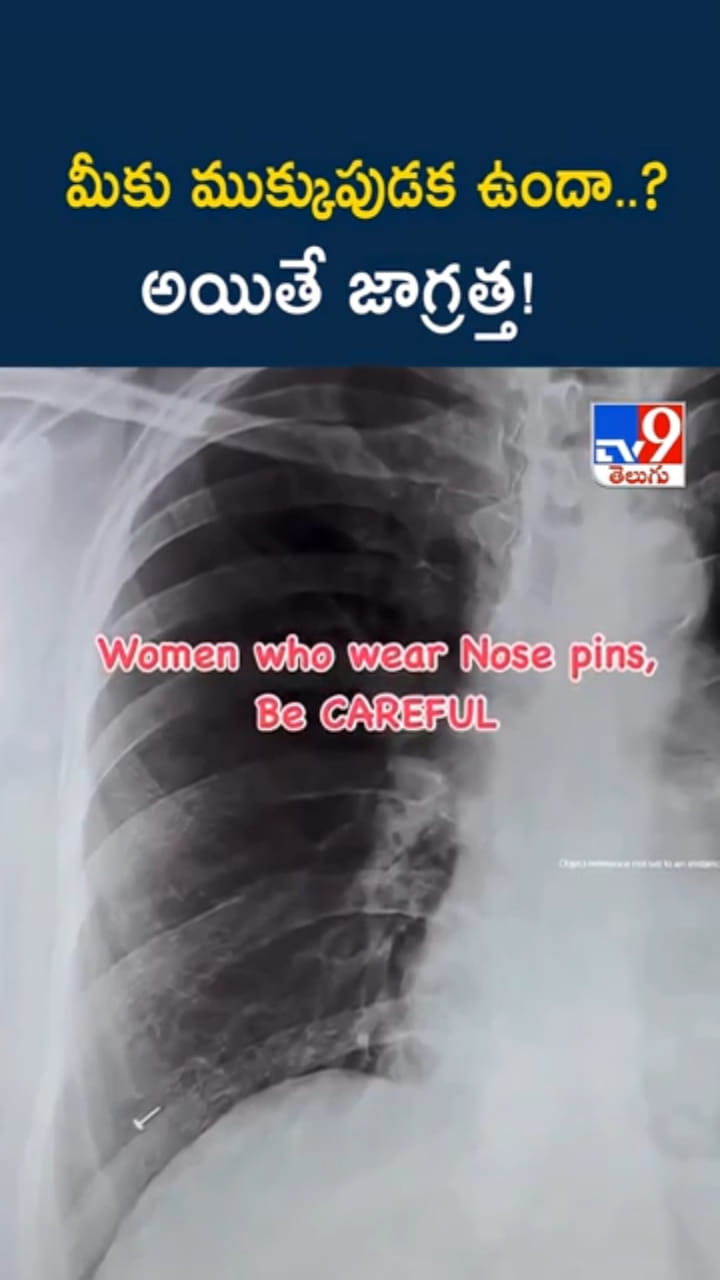 వామ్మో.. ప్రాణం మీదకు తెచ్చిన ముక్కుపుడక..! లేడీస్ బీ అలెర్ట్..