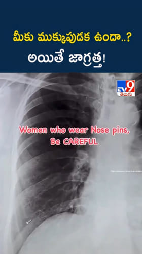 వామ్మో.. ప్రాణం మీదకు తెచ్చిన ముక్కుపుడక..! లేడీస్ బీ అలెర్ట్..