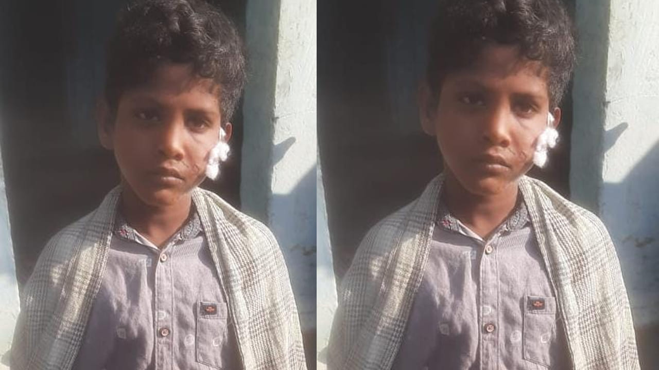 Andhra: కుక్క కరవగానే వెంటనే రేబిస్ వ్యాక్సిన్ వేయించారు.. కానీ కొన్ని రోజుల తర్వాత..