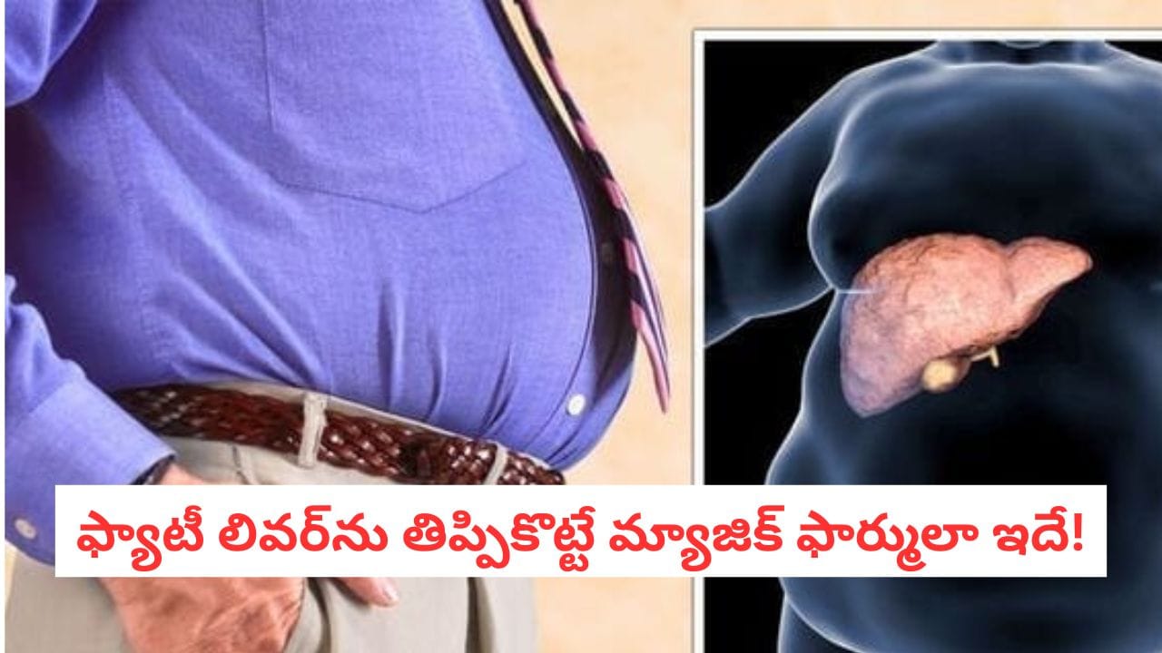 Fatty Liver Tips: ఫ్యాటీ లివర్ను రివర్స్ చేసే పవర్ఫుల్ రెమిడీ.. ఆరు నెలల్లో కాలేయం మొత్తం క్లీన్!