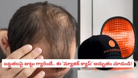 బట్టతలపై జుట్టు గ్యారెంటీ.. ఈ 'మ్యాజిక్ క్యాప్' అద్భుతం చూడండి!