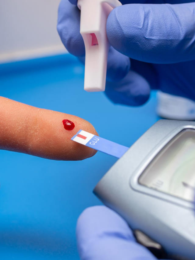 షుగర్ ఉన్న వాళ్లు ఈ పండ్లు తినకూడదు? తింటే, ఇక మీ పని  గోవిందా..