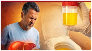 Candle Bush: మీరెప్పుడైనా కొవ్వొత్తి పువ్వులను చూశారా?.. వీటి ప్రత్యేక తెలిస్తే వెంటనే తెచ్చి పెంచుకుంటారు!