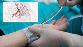 అసలు యాంజియోగ్రామ్ అంటే ఏంటి..?