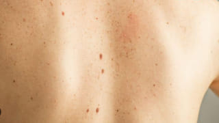 కడుపు ఉబ్బరమా..? ఏసీడీటీనా..? తేడా చేసుకోకపోతే.. భారీ మూల్యం చెల్లించుకోక తప్పదు..!