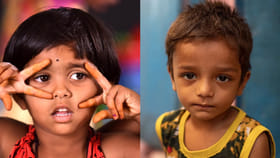 పిల్లల్లో ప్రోటీన్ లోపం లక్షణాలు, గుర్తించే మార్గాలు..