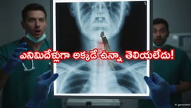 పొరపాటున 12 సెంటీమీటర్ల ఇనుప కడ్డీని మింగేశాడు. 8ఏళ్లుగా అక్కడే