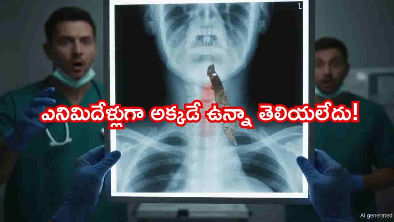 పొరపాటున 12 సెంటీమీటర్ల ఇనుప కడ్డీని మింగేశాడు. ఎనిమిదేళ్లుగా అక్కడే ఉన్నా తెలియలేదు! డాక్టర్లే అవాక్కయ్యారు..