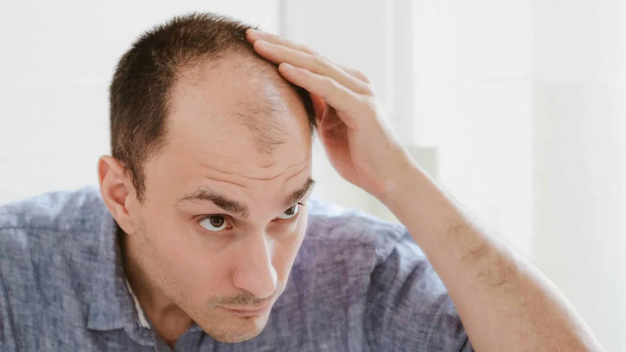 ఉదయం నిద్రలేవగానే అద్దంలో చూసుకున్నప్పుడు రాలిన జుట్టును చూసి ఆందోళన చెందని పురుషుడు ఈ రోజుల్లో అరుదు. జుట్టు పలచబడటం, నుదురు వెనక్కి వెళ్లడం వంటివి కేవలం సౌందర్య సమస్యలు మాత్రమే కాదు, అవి మీ శరీర అంతర్గత అనారోగ్యానికి సంకేతాలని తాజా అధ్యయనాలు హెచ్చరిస్తున్నాయి. ముఖ్యంగా 1.6 లక్షల మంది భారతీయ పురుషులపై జరిపిన ఒక భారీ సర్వేలో, జుట్టు రాలడానికి మలబద్ధకం, జీర్ణ సంబంధిత సమస్యలే ప్రధాన కారణమని తేలింది.

