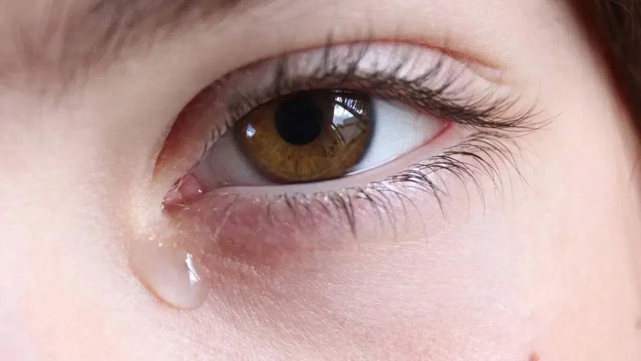 కాలేయం ఎక్కువగా క్షీణించడం ప్రారంభిస్తే దాని లక్షణాలు మన కళ్ళలో కనిపిస్తాయి. దీని వల్ల కళ్ళు నేరుగా ప్రభావితమవుతాయి. కళ్ళు పసుపు రంగులోకి మారుతాయి. దీనిని మనం కామెర్లు అని పిలుస్తాం. 