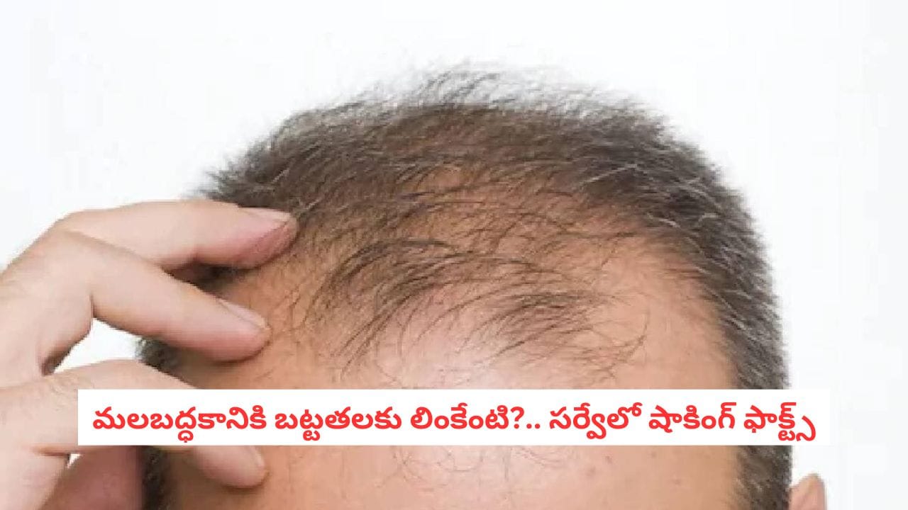 HairLoss Alert: మలబద్ధకానికి బట్టతలకు లింకేంటి?.. 1.6 లక్షల మందిపై జరిపిన సర్వేలో షాకింగ్ ఫాక్ట్!