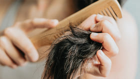 జుట్టు విపరీతంగా ఊడి పోతుందా? లైట్‌ తీసుకుంటే మిగిలేది విగ్గే..