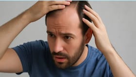 మీ జుట్టు రాలడానికి మెయిన్ రీజన్స్ ఇవే కావొచ్చు.. లైట్‌ తీసుకుంటే