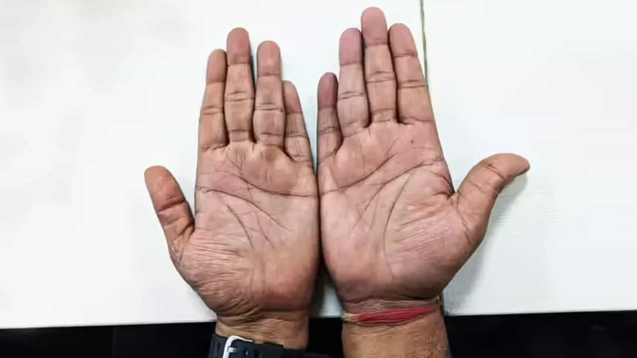 
మణిబంధ రేఖల విశేషాలు.. 

ఒక వ్యక్తికి మణిబంధ రేఖ ఉంటే, అతనికి సమాజంలో గౌరవం లభించి, వృత్తిలో ఉన్నత స్థాయికి చేరుకుంటాడని చెబుతారు.
రేఖలు స్పష్టంగా, లోతుగా ఉంటే, ఆ వ్యక్తి జీవితంలోని వివిధ రంగాల్లో విజయాన్ని సాధిస్తాడు. ఒక్క మణిబంధ రేఖ మాత్రమే ఉన్నవారు ఆరోగ్యంగా ఉండి, దీర్ఘాయుష్షు పొందుతారని విశ్వాసం.
