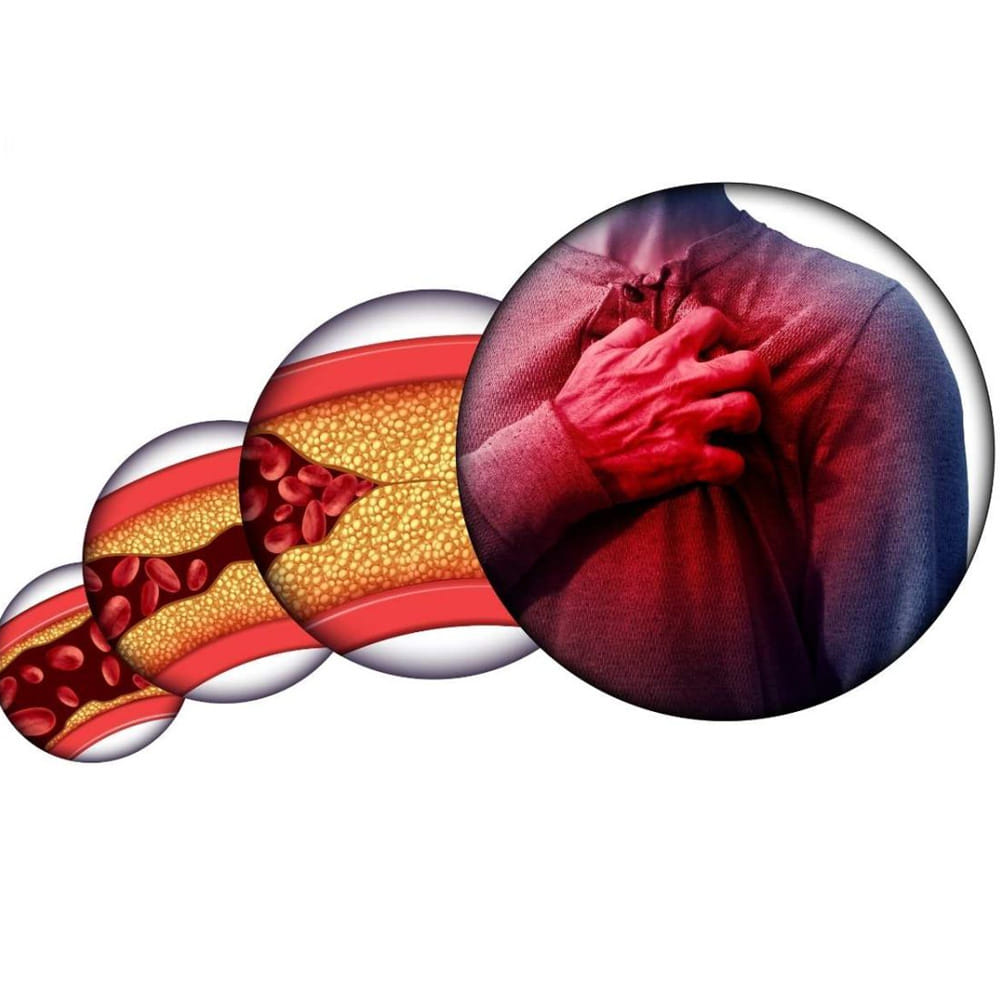 గుండె సమస్యలకు కారణాలు: అధిక రక్తపోటు, కొలెస్ట్రాల్, మధుమేహం నియంత్రణ లోపం, అధిక బరువు, శారీరక శ్రమ లేకపోవడం, ఒత్తిడి వంటివి గుండె సమస్యలకు ప్రధాన కారణాలు. ఈ సమస్యలను అధిగమించడానికి, రాకుండా నివారించడానికి సహజసిద్ధమైన ఆహార పదార్థాలు ఎంతగానో ఉపయోగపడతాయి.