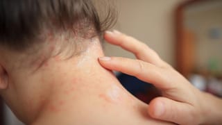 స్టవ్ వెలిగించే ముందు ఇలా చేస్తే బోలెడంతా గ్యాస్ ఆదా.. ఈ సీక్రెట్స్ తప్పక తెలుసుకోండి..