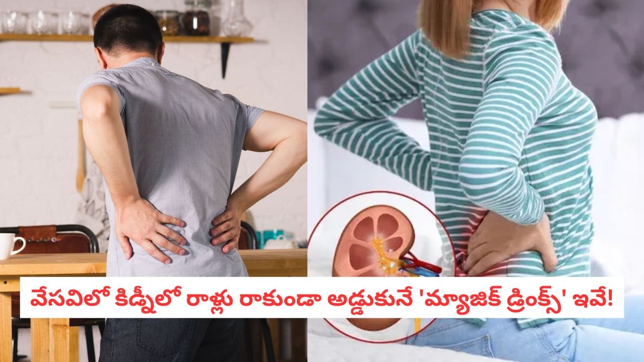 Kidney Stones: ఎండలు ముదురగానే కిడ్నీలో రాళ్లు ఎందుకొస్తాయి?.. యూరాలజీ నిపుణుల షాకింగ్ హెచ్చరికలివే!