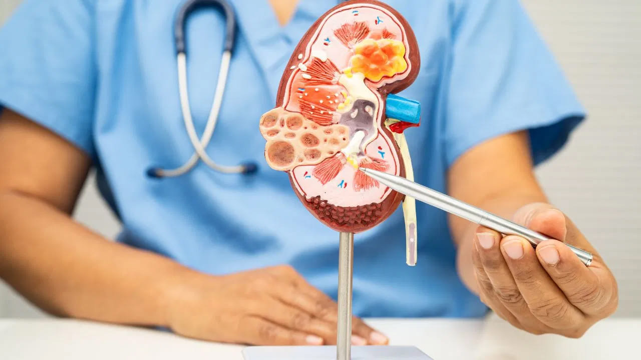 పాలులోని కాల్షియం మూత్రపిండాల్లో రాళ్ల ప్రమాదాన్ని పెంచుతుంది’ అని చాలామందికి నమ్మకం ఉంది. కానీ నిపుణుల అభిప్రాయం ప్రకారం ఇది పూర్తిగా నిజం కాదు. రాళ్ల ప్రధాన కారణం కాల్షియం ఆక్సలేట్, కానీ పరిమిత మోతాదులో పాలు తాగడం రాళ్ల ప్రమాదాన్ని పెంచదు. నిజానికి, పాలలోని కాల్షియం ఆక్సలేట్తో బంధం ఏర్పరచి, దాన్ని శరీరం నుంచి బయటకు పంపడంలో సహాయపడుతుంది. ముఖ్యంగా 5 మి.మీ. కంటే చిన్న రాళ్లకు ఇది పనిచేస్తుంది.