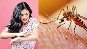 దోమల బెడదతో విసిగిపోయారా..? ఈ నేచురల్ టిప్స్ పాటిస్తే ఒక్కటి కూడా