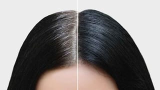 ఎండాకాలంలో వడ గళ్ల వానలు ఎందుకు వస్తాయో తెలుసా?