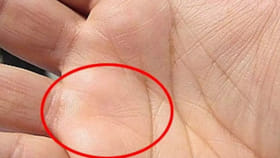 మీ అరచేతిలో ఉండే అశుభ రేఖల గురించి తెలుసా?