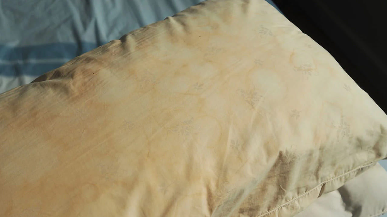 అలర్జీలు, బ్యాక్టీరియా: మనం నిద్రపోయేటప్పుడు మన చర్మం నుండి రాలిన మృత కణాలు, చెమట, నూనెలు దిండులోకి చేరుతాయి. ఏళ్ల తరబడి ఒకే దిండును వాడటం వల్ల అందులో డస్ట్ మైట్స్ (దుమ్ము పురుగులు) చేరి అలర్జీలు, తుమ్ములు, శ్వాసకోశ సమస్యలను కలిగిస్తాయి.