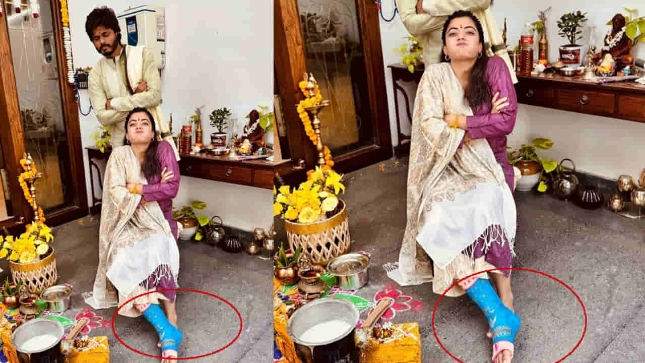 Rashmika Mandanna: అరె.. కొత్త కోడలికి ఏమైంది? కాలికి కట్టుతో కనిపించిన రష్మిక.. ఫొటోస్ వైరల్