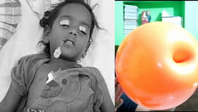 చిట్టి తల్లి ప్రాణం తీసిన బెలూన్...